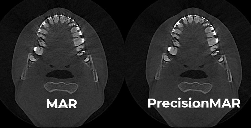 PrecisionMAR