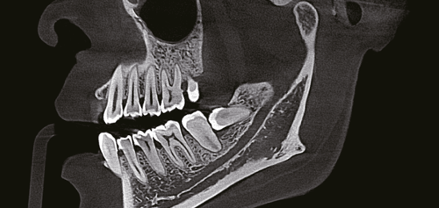 Finscan F350 AI — 3D-томография (CBCT)